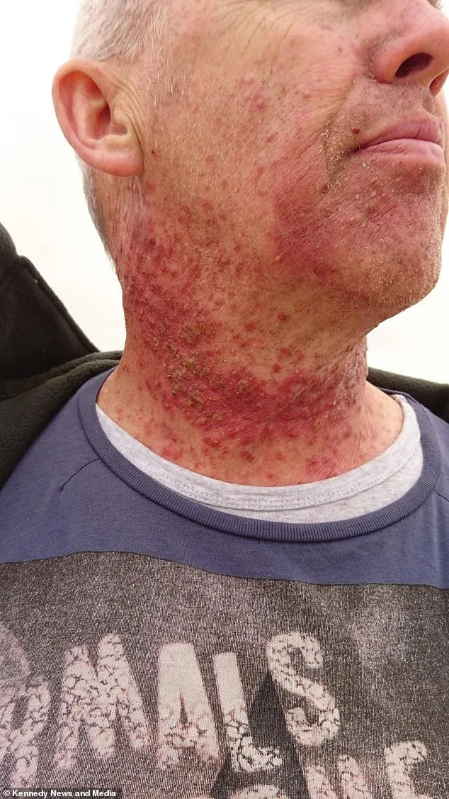 Virus-Linked Cancer Leaves Scottish Family in Shock