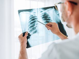 New urine test could detect lung cancer early in UK NHS within five years.