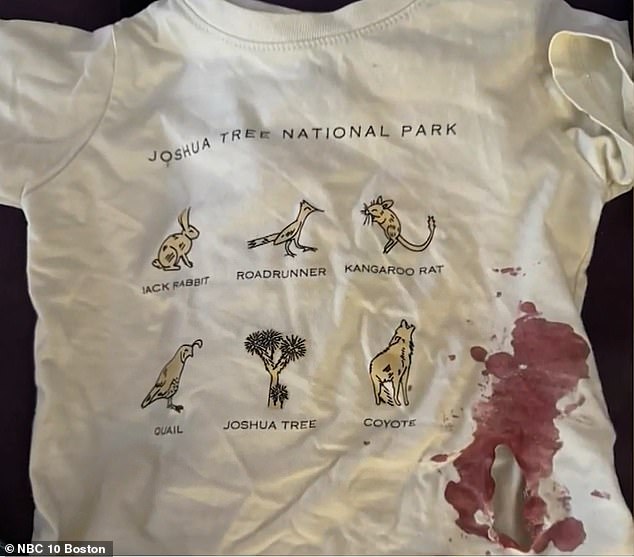 Massachusetts toddler suffers severe raccoon attack on suburban playground.