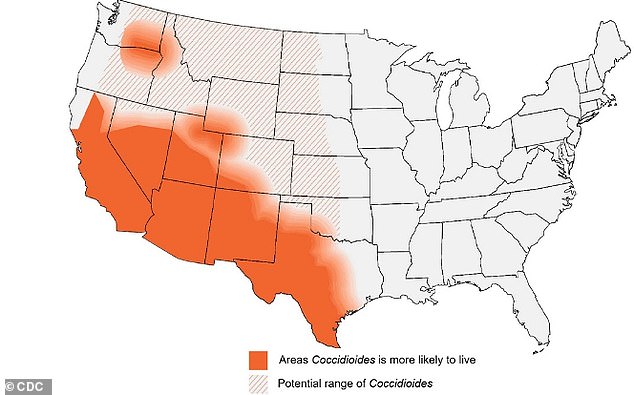 Drought-Driven Fungal Storms Will Spread Deadly Valley Fever Across 11 States This Summer