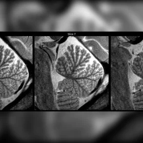 Des images incroyables du cerveau d'un enfant de 6 ans