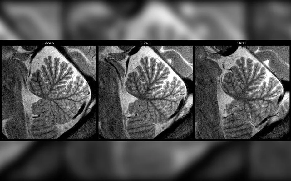 Des images incroyables du cerveau d'un enfant de 6 ans