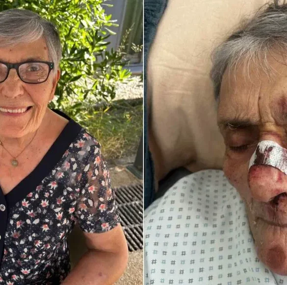 Le visage contusionné de Jeanine révèle les négligences de l'Ehpad Les Oliviers-de-Saint-Jean