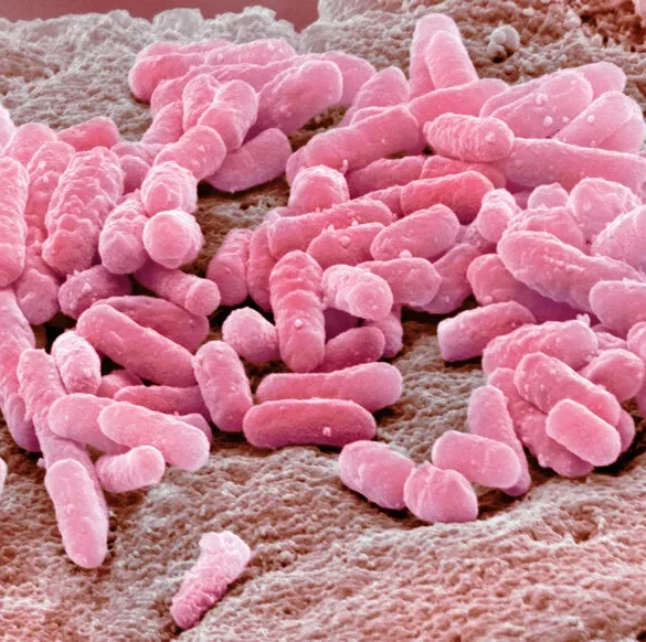 Maladie mystérieuse chez les touristes à La Manga