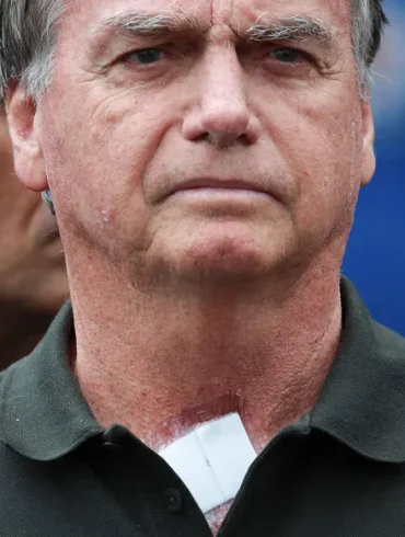 Jair Bolsonaro : hospitalisation après des symptômes inquiétants